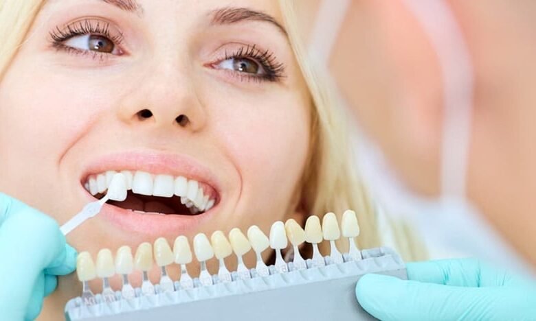how to fill a missing tooth gap at home